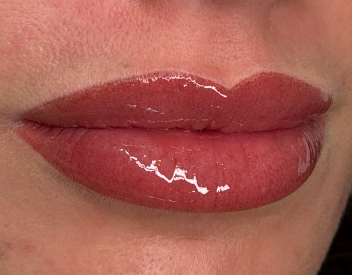 Lips after the second lip blush treatment