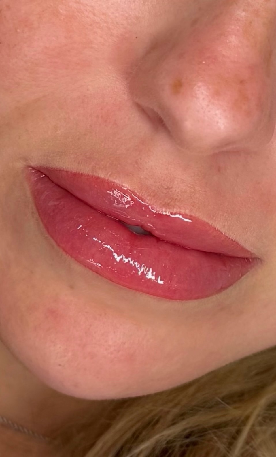 Lips after lip blush, mirrored to match the camera angle