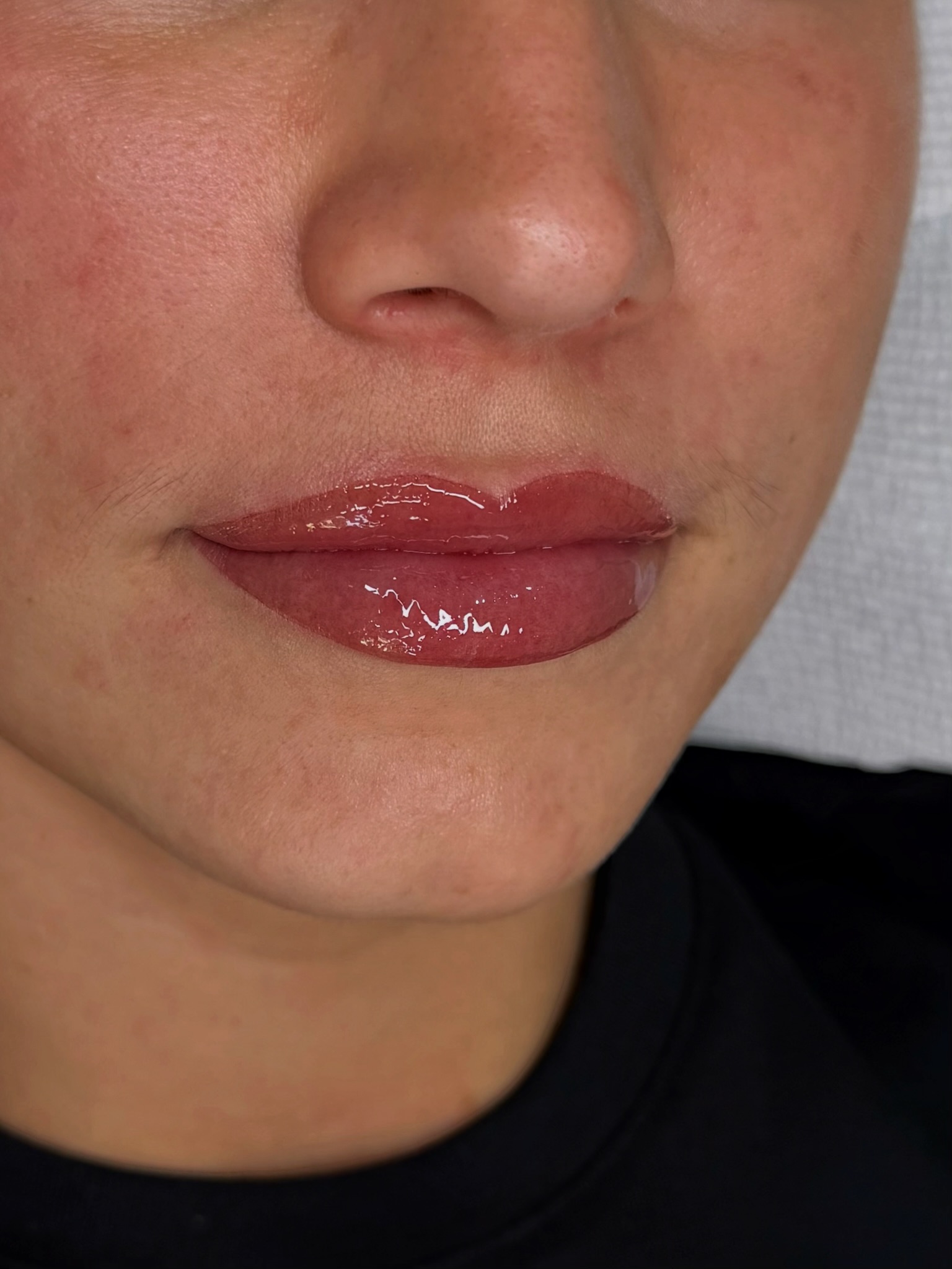 Client lips after lip blush