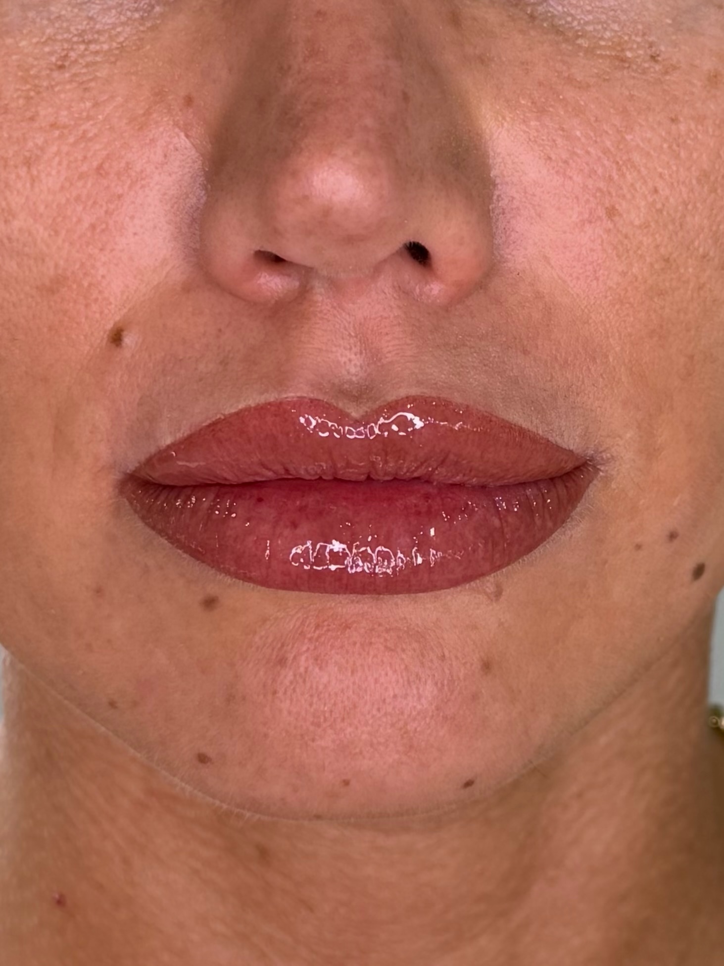 Lips after lip blush